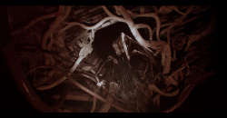 Post Trauma